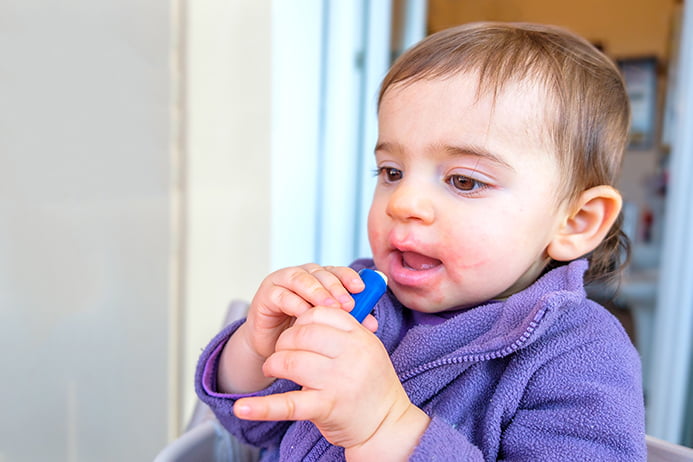 röda kinder allergi röda kinder allergi